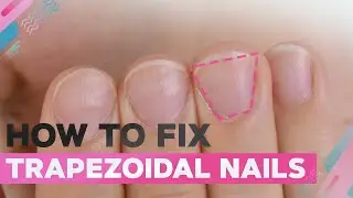 How to Fix Trapezoidal Nails | Almond Shape | Soft Neon Nail Art