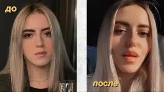 ВЛОГ: я увеличила губы! реакция мамы | мой доход, цели | день с подругами