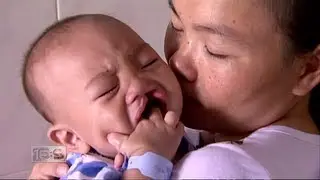 16x9 - Smile China: Fixing kids facial deformities