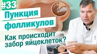 Пункция фолликулов Как происходит забор яйцеклеток при ЭКО? Сколько времени занимает процедура?