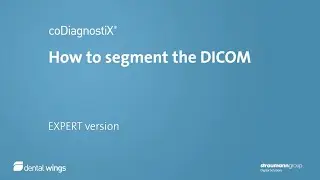 coDiagnostiX® – How to segment DICOM data