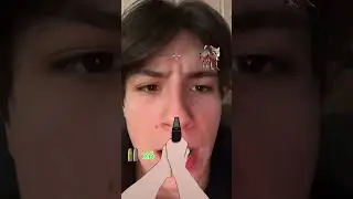 ИТАЛЬЯНСКИЕ ЖИВОТНЫЕ ПРОТИВ ДАЧНИКА