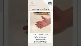 טיפול סו-ג'וק לפציאליס - שיתוק במחצית הפנים- עם דר' זוהר יגיל