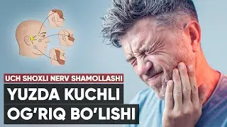 Uch shoxli nerv shamollashi | yuzdagi og'riq sababi!