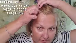 Шунтирование желудка - ОТЗЫВ. Питание,порции и витамины.