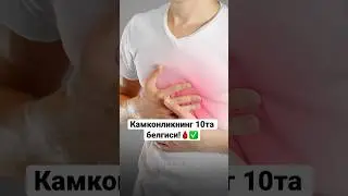 камконликнинг белгилари🩸✅