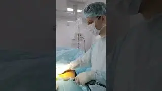 #shortsvideo