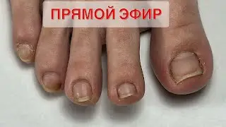 ПЕДИКЮР ОНЛАЙН. Виктория Авдеева