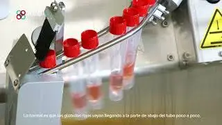 PRUEBA DE VELOCIDAD DE SEDIMENTACIÓN GLOBULAR │¿En qué consiste?