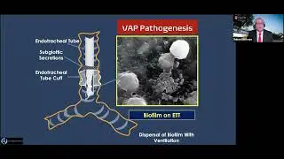Ventilator Associated Events New Challenges to Well Known Complications