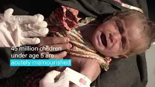 Donate to fight malnutrition crisis