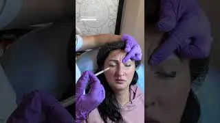 Как колоть ботокс? Запись на все обучающие программы ➡️ inst:dr.antonina_guz