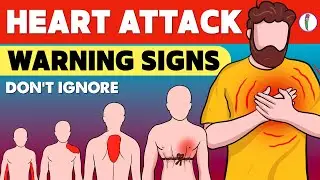 Heart Attack Symptoms | Heart Attack vs Heart Burn | Myocardial Infarction | Chest pain (Types)
