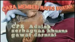 Cara Memberikan Nafas Buatan gawat Darurat