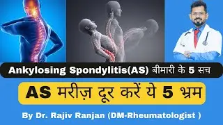 अगर आपको AS है तो जाने ये 5 सच | Ankylosing Spondylitis | HLA-B27 +