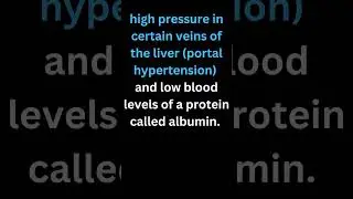 #ascites