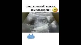 ривожланмай колган хомила😔