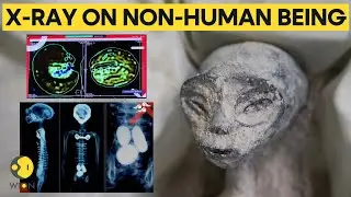 Mexican UFO expert conducts x-rays on non-human beings presented at Congress | WION Originals