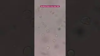 Red blood cell in urine under the microscope 
