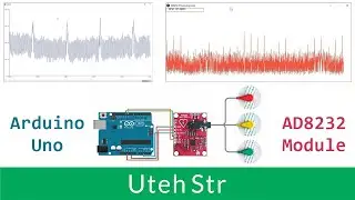 Arduino + AD8232 Module + Processing IDE | Arduino Uno with AD8232 Heart Monitor and Processing IDE