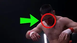 ЖУТКАЯ ТРАВМА!!! Профессор VS Дикий. Топовые Нокауты