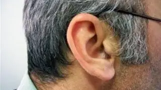 How To Unclog Your Ears