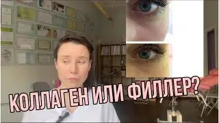 Сферогель или филлер? 