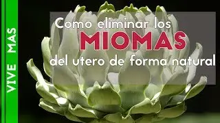 como eliminar los miomas del utero de forma natural