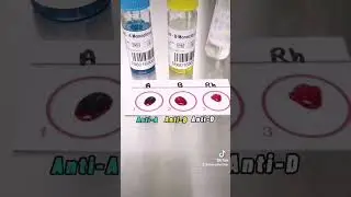 Blood typing Or Blood grouping step by step 
