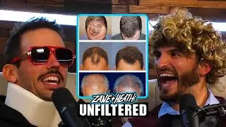 ZANE & HEATH DISCUSS THEIR HAIR TRANSPLANTS