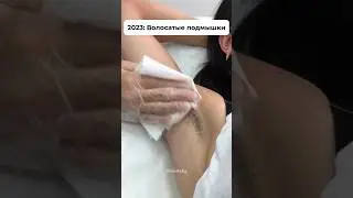 #лазернаяэпиляция