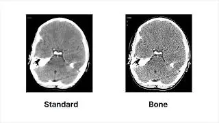 What happens during the reconstruction process to create a CT image?: CT physics