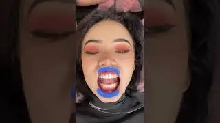 Karrambaby вставила кристаллы в зубы 🤯