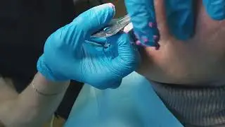 Бюджетное протезирование пациентки "Ш". 3 часть. Обучающее видео для вр.-интернов. 4-я стоматология.