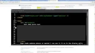 11 How to Edit options Brackets