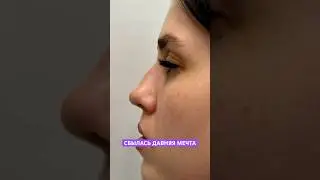 Всего неделя после операции 🥰