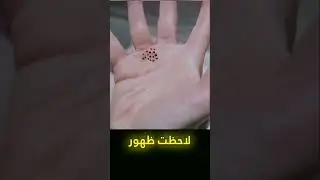 رهاب الثقوب #shorts