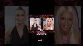 БУЗОВА НЕ ДЕЛАЛА ПЛАСТИКУ?
