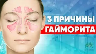 Как убрать гайморит без антибиотиков за ЧАС?