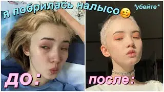 Я Побрилась Налысо (волосы ТОЧНО ПОКИНУЛИ ЧАТ)