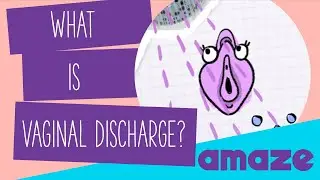 What Is Vaginal Discharge? 