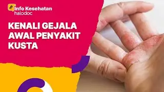 Gejala Awal Penyakit Kusta yang Perlu Diperhatikan