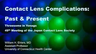 Acanthamoeba Keratitis William Ehlers  MD
