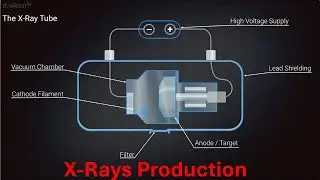 X Rays Production