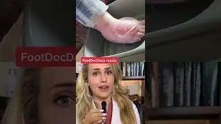 Doctor reacts: world's biggest blister