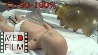 Neonatal resuscitation ©