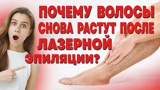 ПОЧЕМУ ВОЛОСЫ СНОВА РАСТУТ ПОСЛЕ ЛАЗЕРНОЙ ЭПИЛЯЦИИ