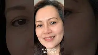 Age Spots and Wrinkles GONE?! Unbelievable Results...