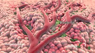 Surgical Debridement Of A Wound| Best Multispeciality Hospital in India| Manipal Hospitals