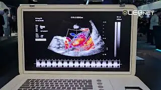 [CES 2025] TCL CSOT, IJP Medical Ultrasound Suitcase